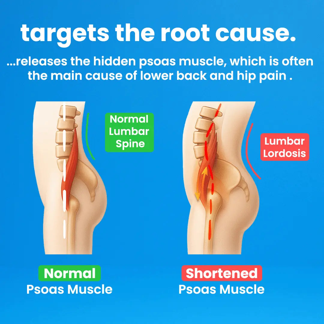 Capabody™ Psoas Peak