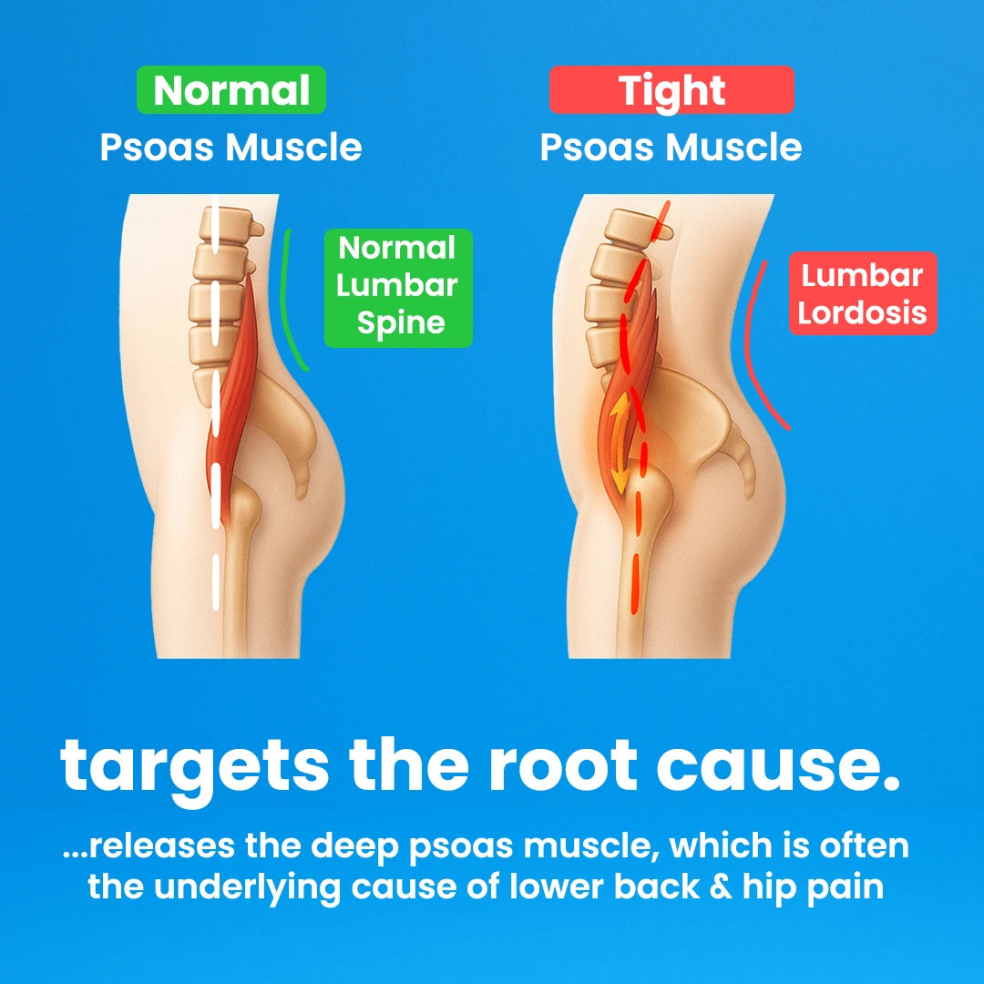 Capabody™ Psoas Peak