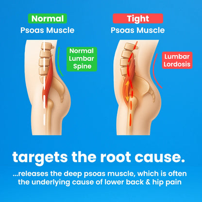 Capabody™ Psoas Peak